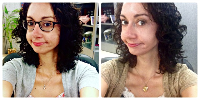 prk-beforeafter